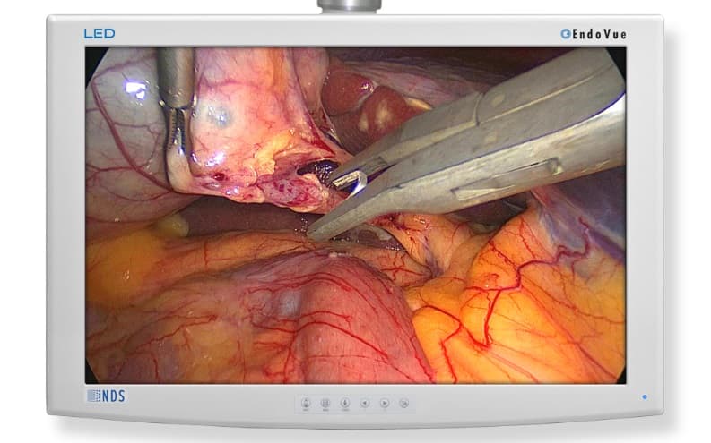 EndoVue-24.jpg