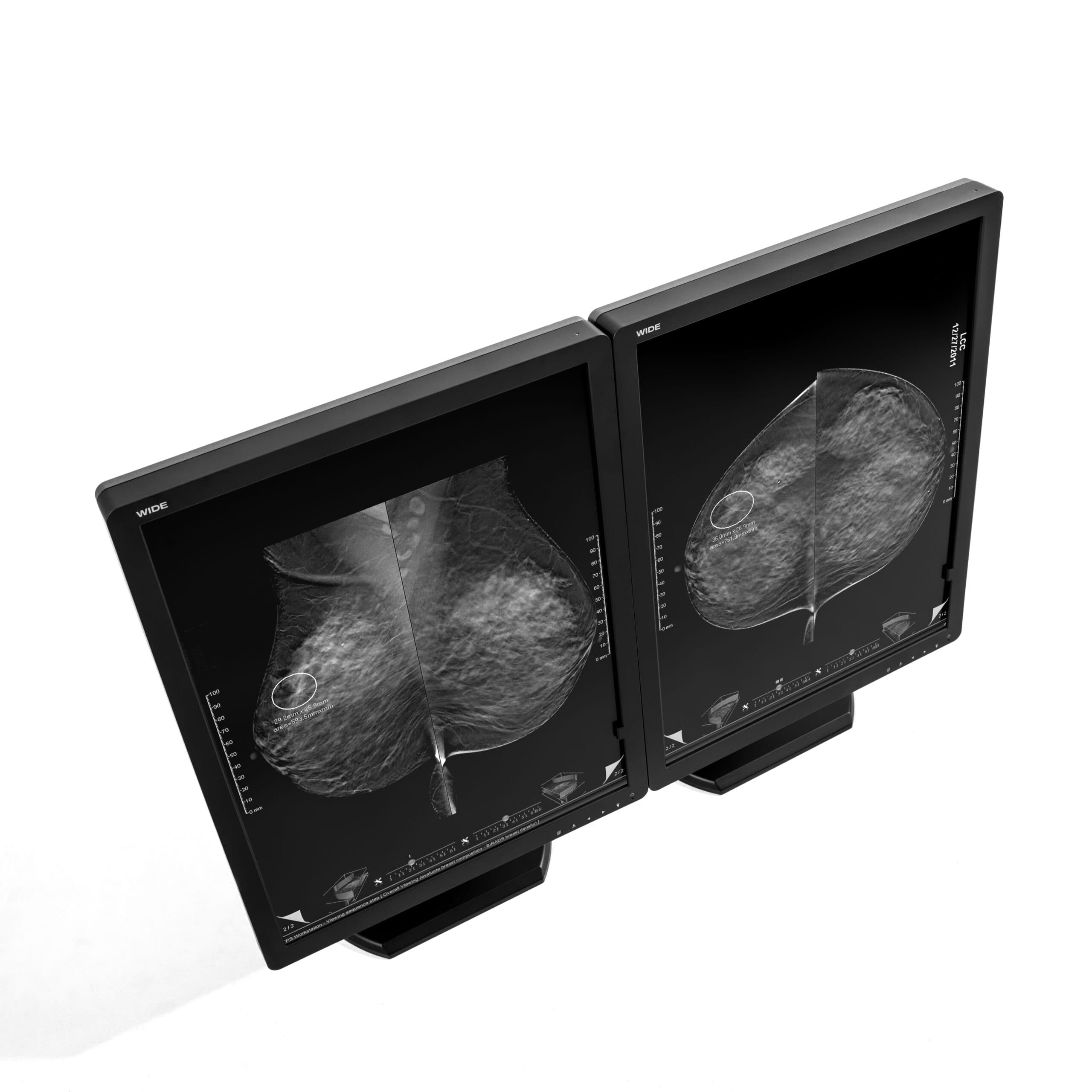 MX50N_Mammo_Tomosynthesis_Mono_Display_1_1-scaled.jpg