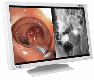 radiance423.png