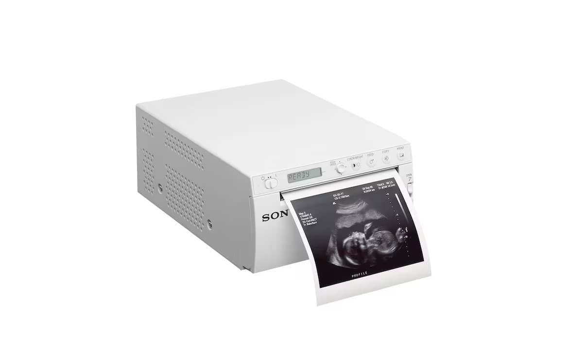 Sony UP-X899MD печатает снимок УЗИ на термобумаге UPP-110