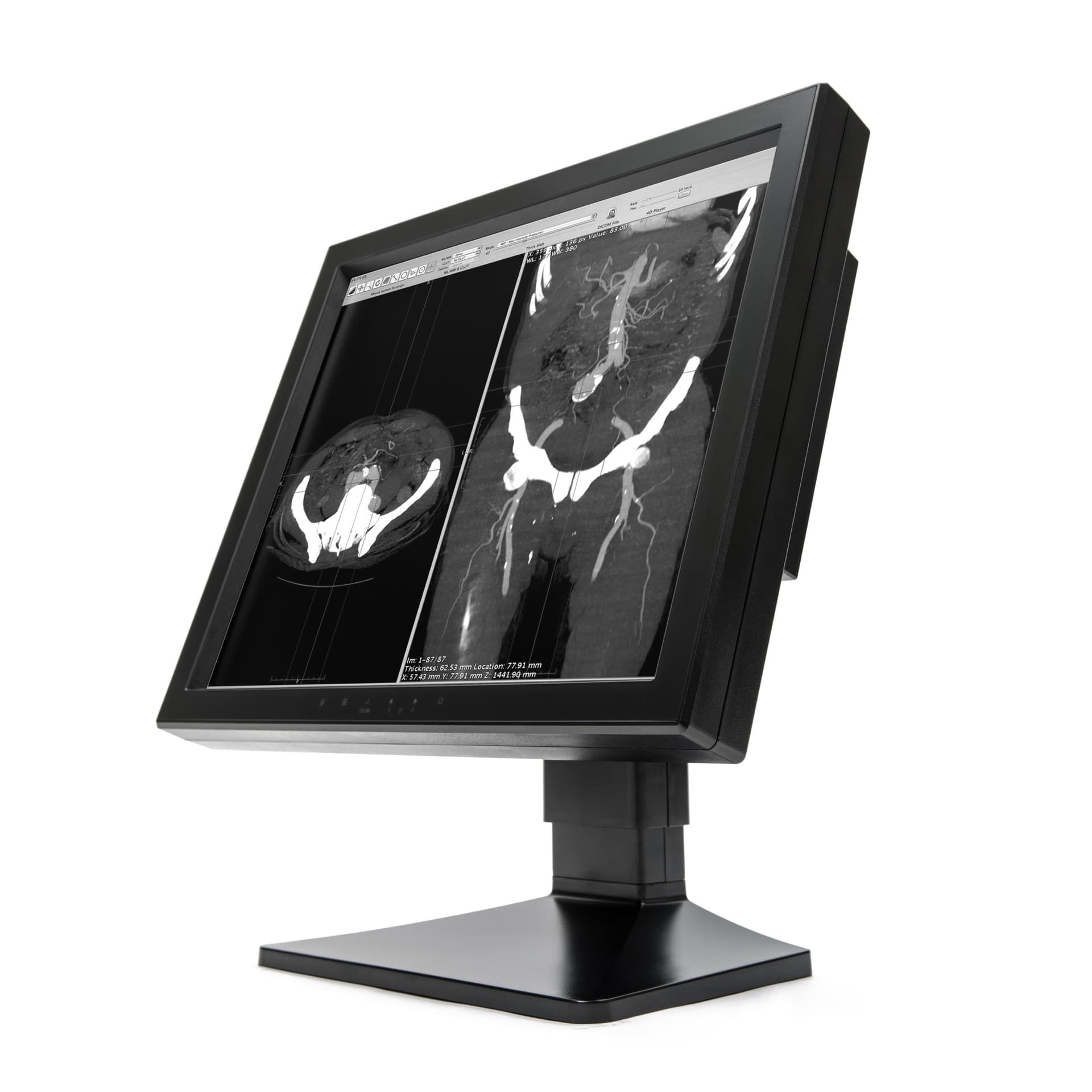 WIDE MX10p — диагностический медицинский монитор 19″ 1MP (монохром)