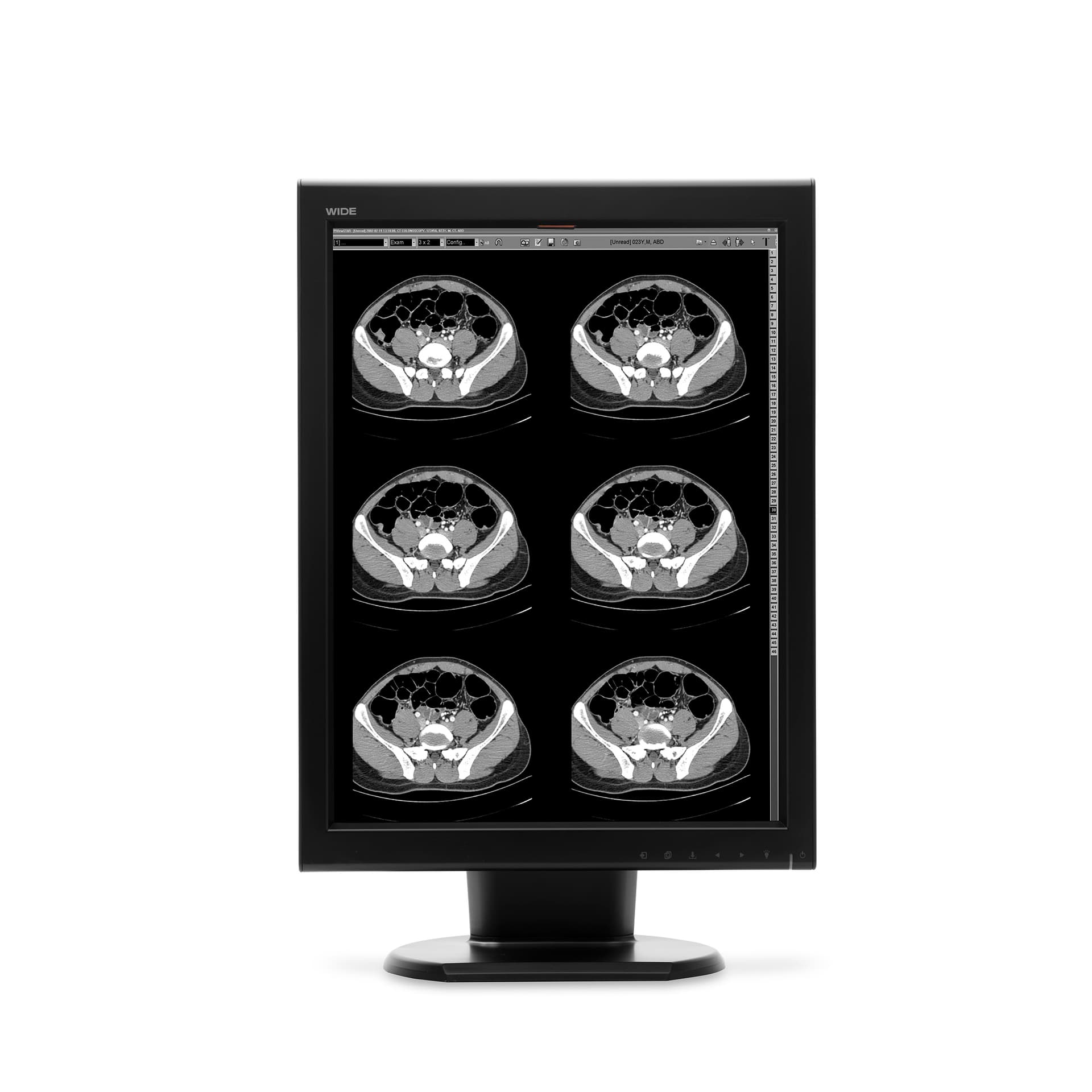 WIDE MX20N — медицинский диагностический монитор 21,3″ 2MP (монохромный)